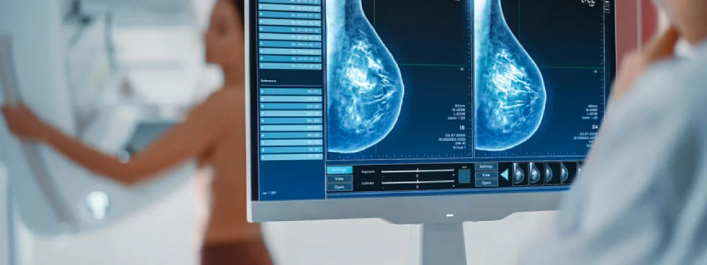 Що показує мамографія